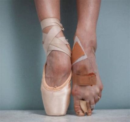 is ballet bad for your feet, and does it really limit future athletic pursuits?